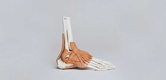 How to Fix High Arched Feet