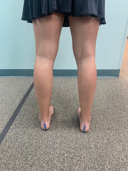 Corrected Foot Calf Stretch